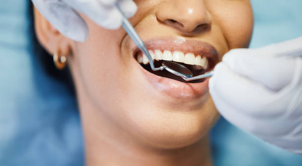 Best Root Canal Emergency Dentist  in Laymantown, VA