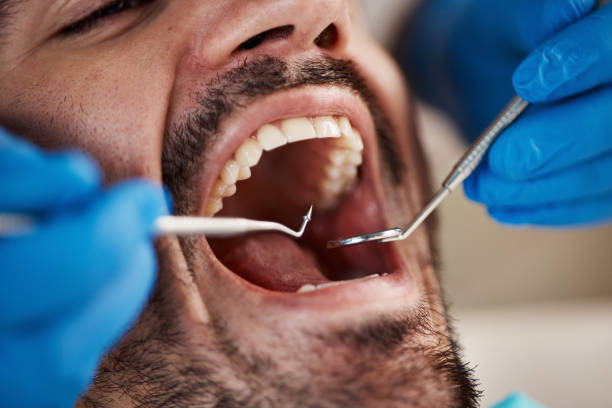 Best Emergency Dental Filling Replacement  in Laymantown, VA