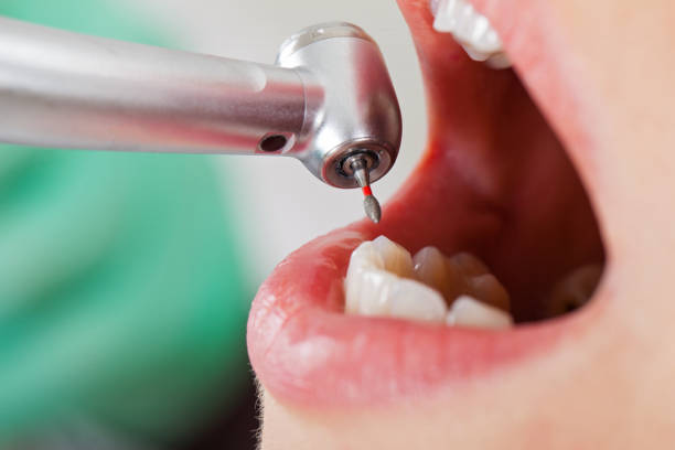 Best Urgent Dental Care  in Laymantown, VA